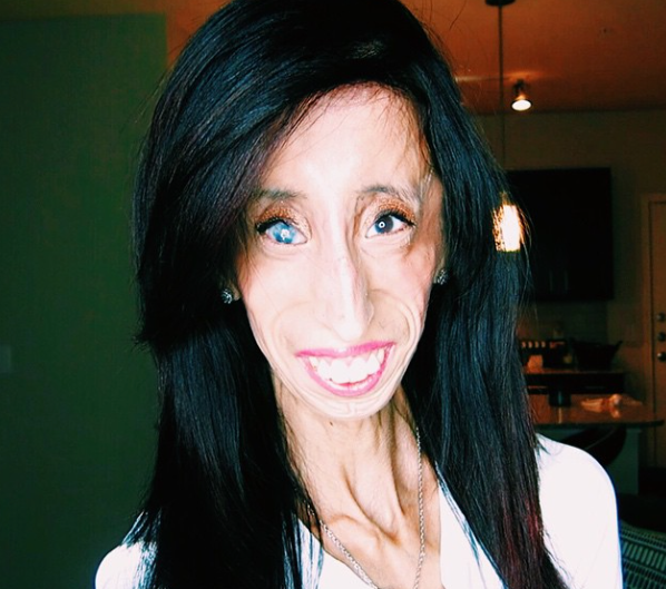 Dubbed The World S Ugliest Woman — Lizzie Velasquez Proves Her Haters