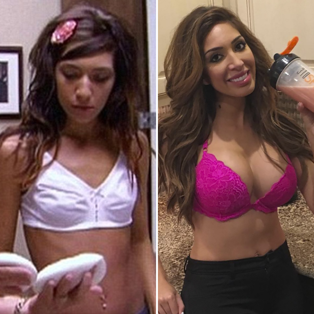 Gigantic Black Tits Farrah - Iggy Azalea, Kaley Cuoco, and More Stars Who Have Admitted to Getting a  Boob Job â€“ See Their Before-and-After Pics - Life & Style