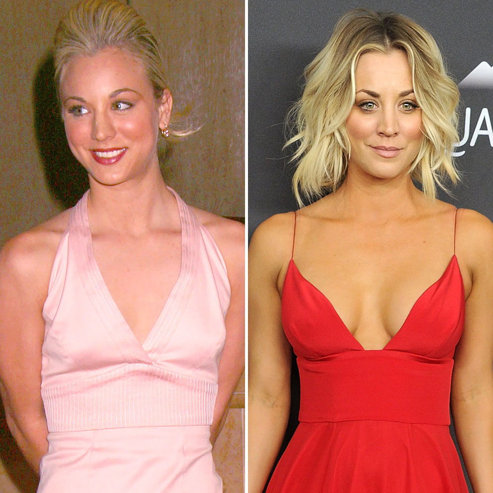 1000px x 1000px - Iggy Azalea, Kaley Cuoco, and More Stars Who Have Admitted to Getting a Boob  Job â€“ See Their Before-and-After Pics - Life & Style