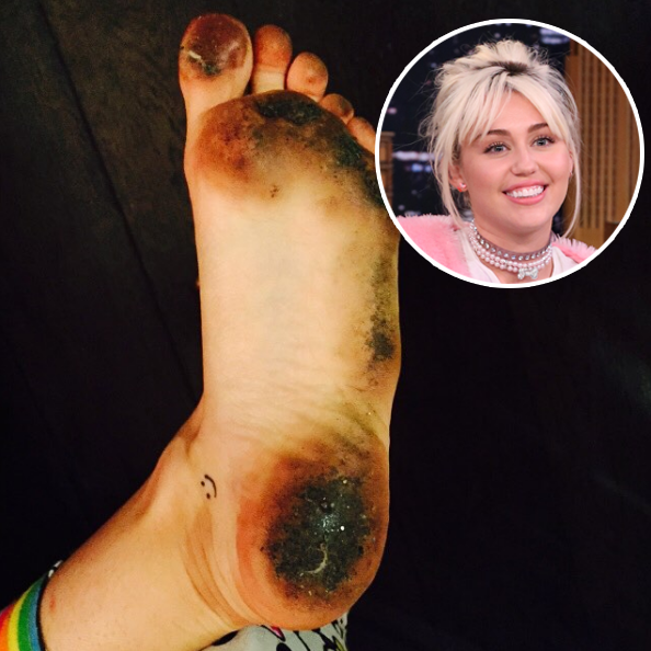 Miley Cyrus Foot Fetish | Sex Pictures Pass