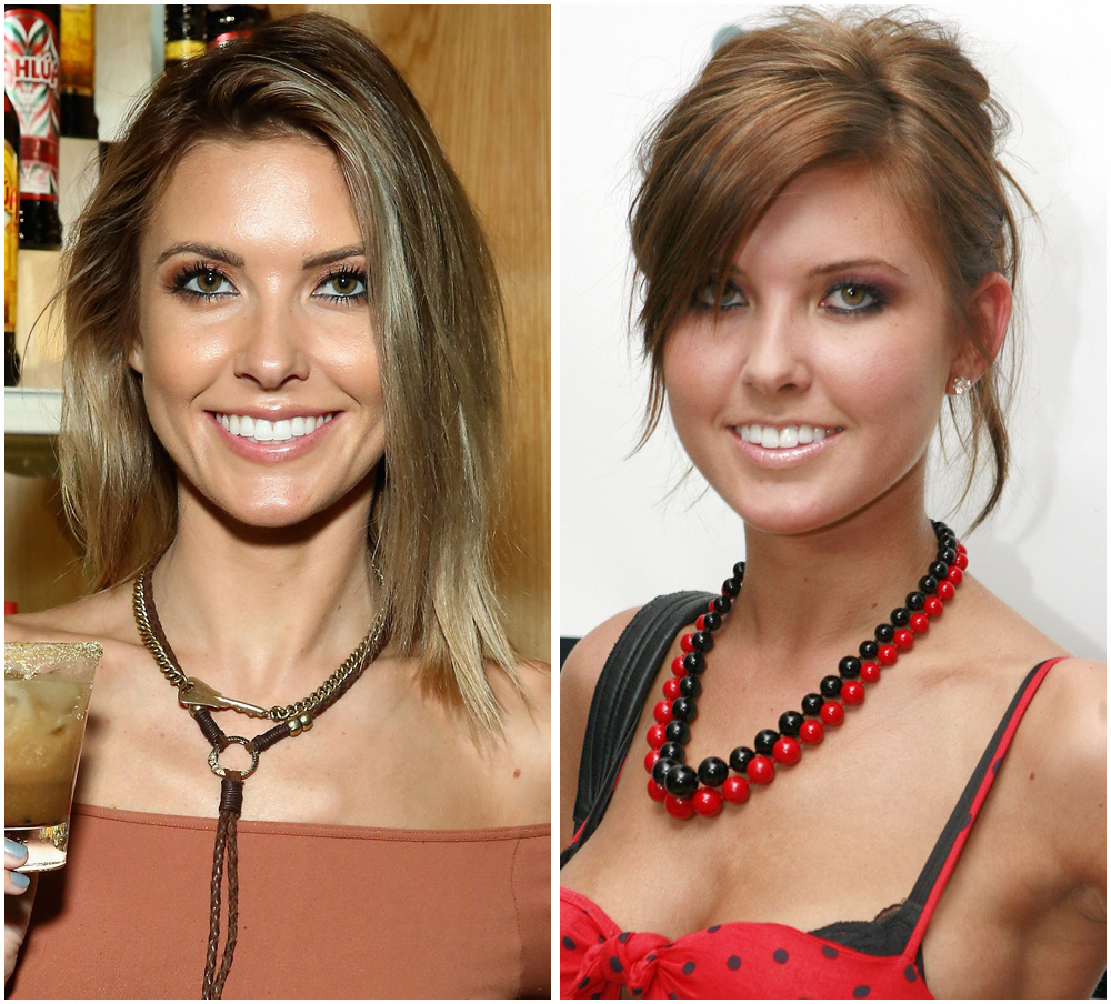 The Hills Cast Before And After Beauty Transformations