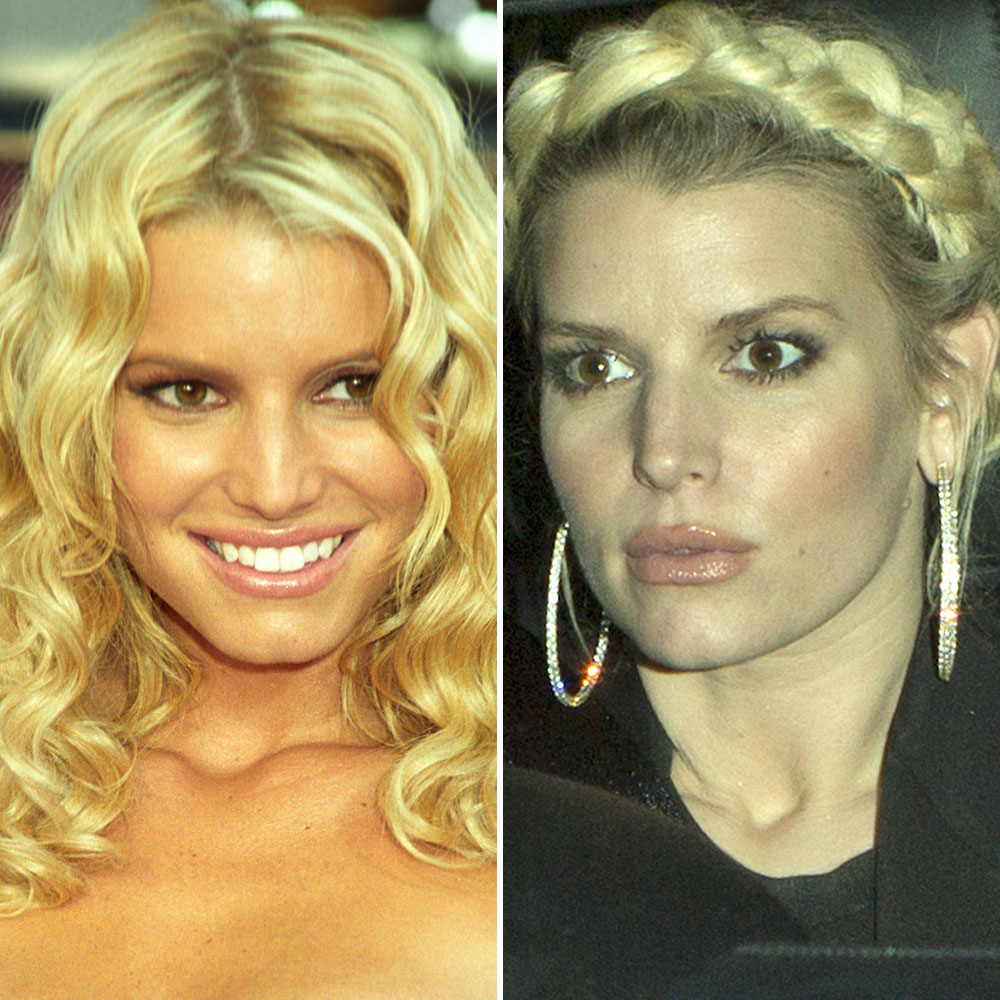 Jessica Simpson, Snooki, and More Stars Who Looked Better Before Lip ...