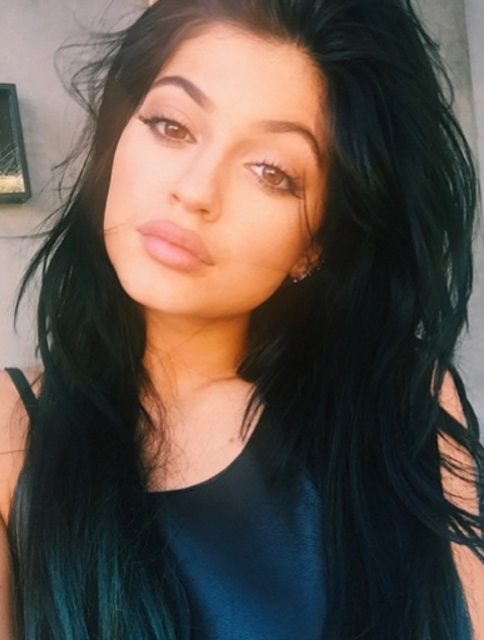 Biggest Lips Porn - Kylie Jenner Got Her Lips Fixed After Making Them \