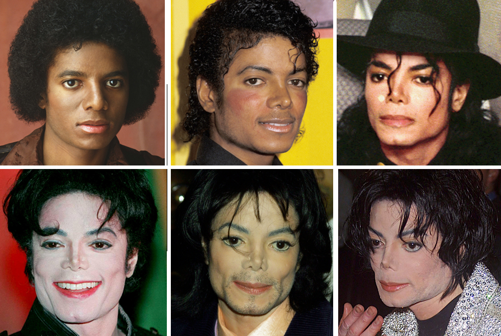 Michael Jackson's Plastic Surgery — See His Transformation