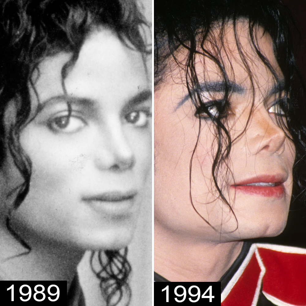 michael jackson nose before and after
