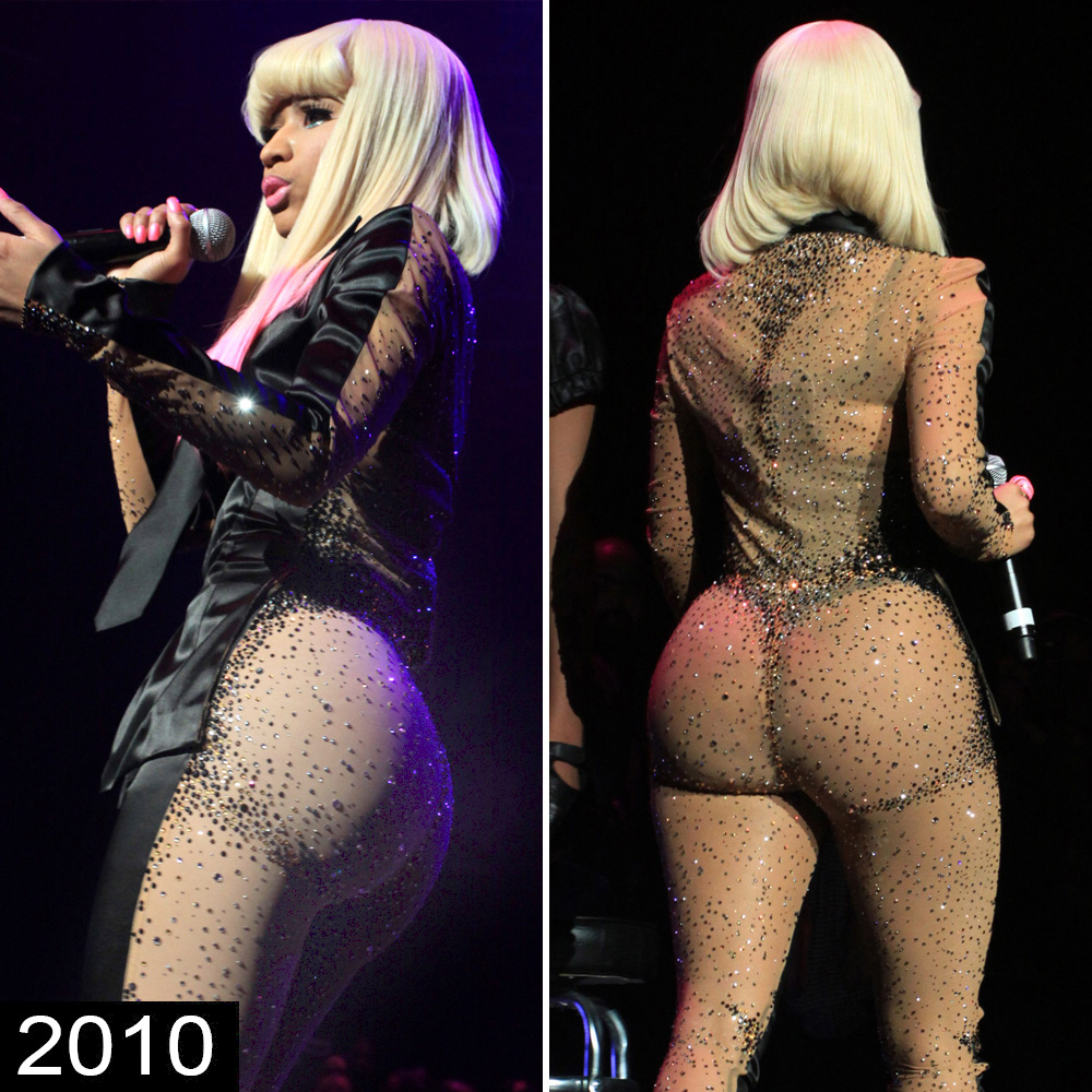 Nicki Minaj Big Booty Black Porn - Did Nicki Minaj's Booty Implant Rupture? See Her Biggest Butt Moments to  Date