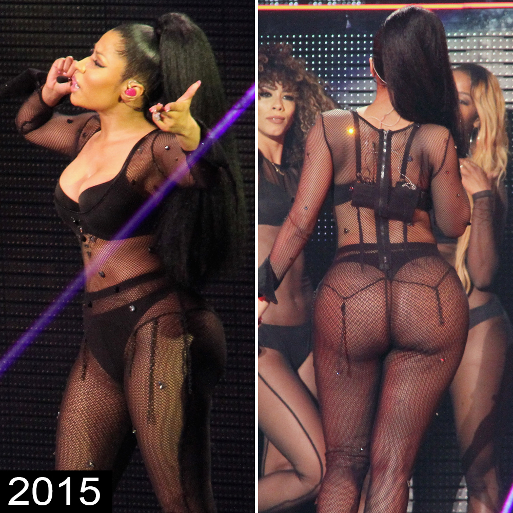 Nicki Minaj Booty Porn - Did Nicki Minaj's Booty Implant Rupture? See Her Biggest Butt Moments to  Date