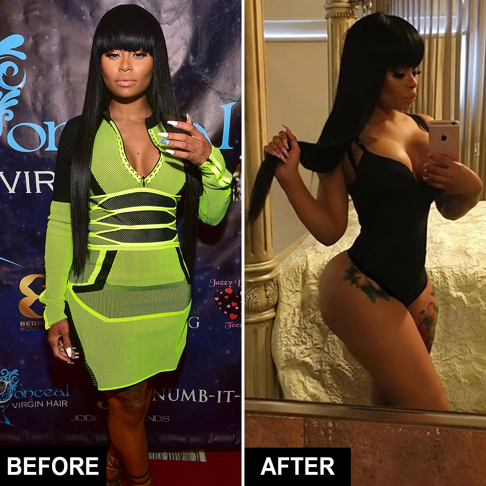 Celebrity Waist Trainers in Action See Before and After Pics