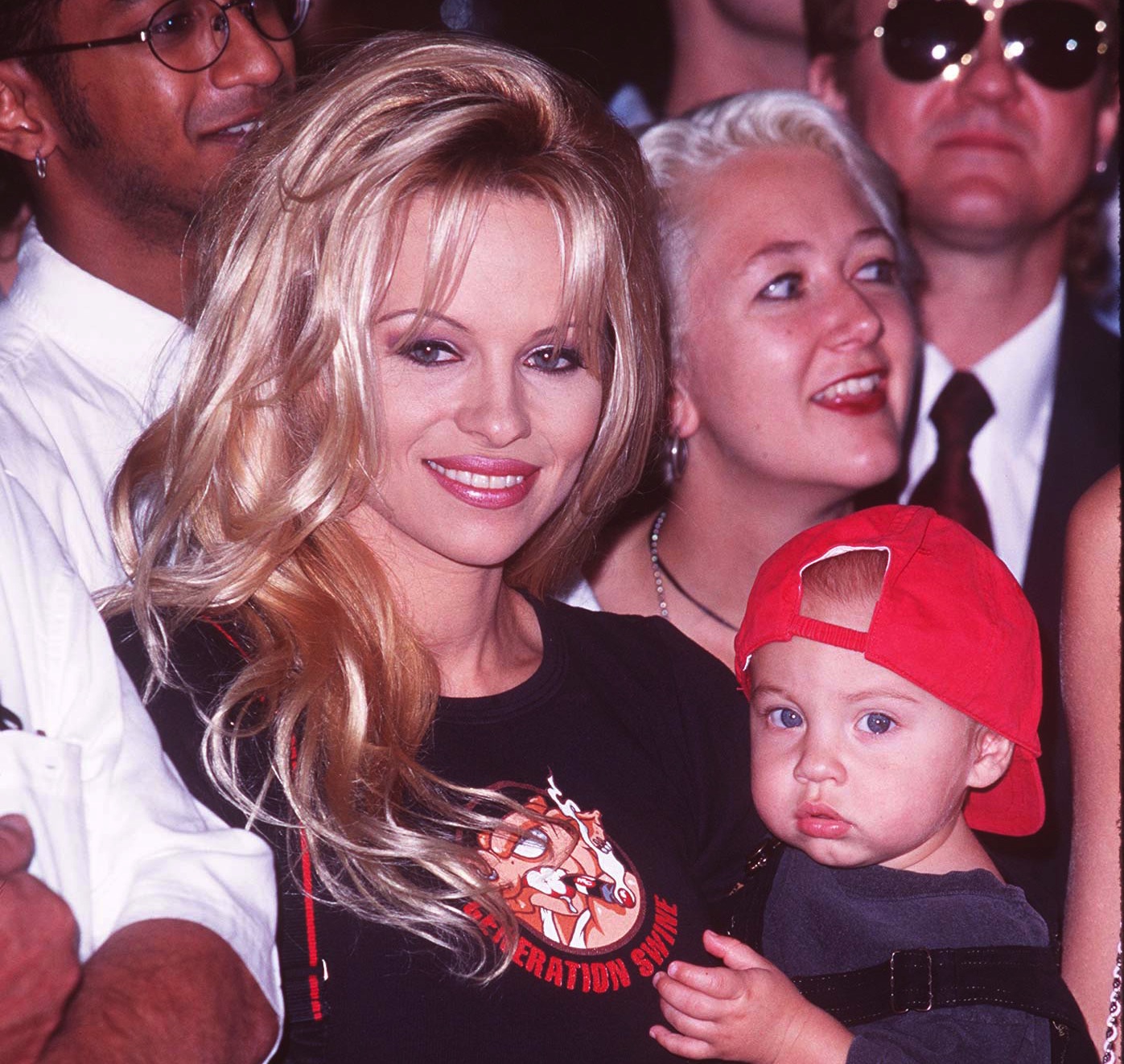 Pamela Anderson Plastic Surgery: See Before and After Photos