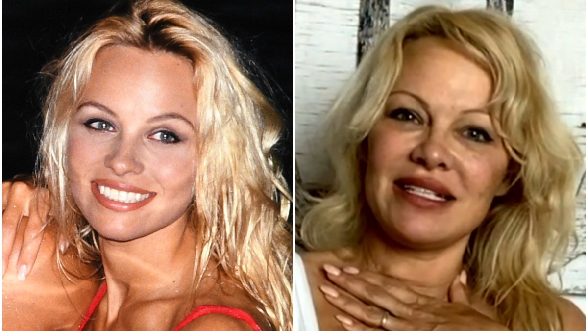 Pamela Anderson Plastic Surgery See Before And After Photos 