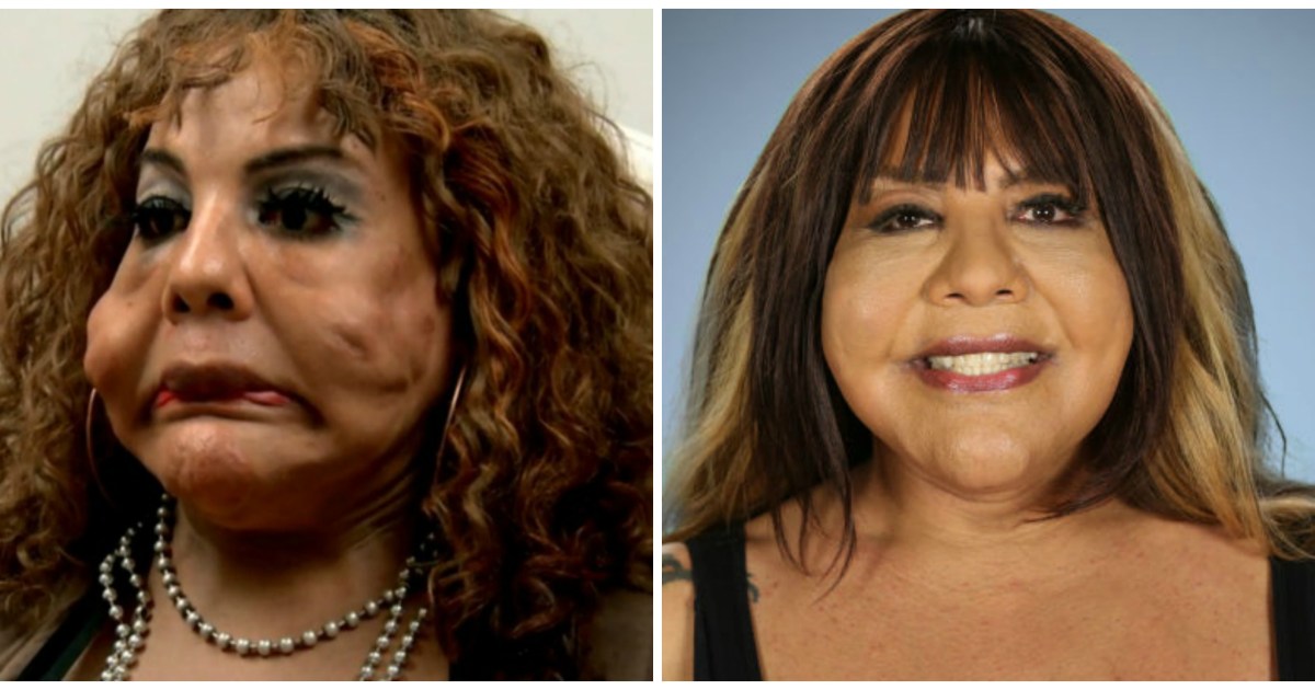 See The Most Extreme Plastic Surgery Transformations On Botched