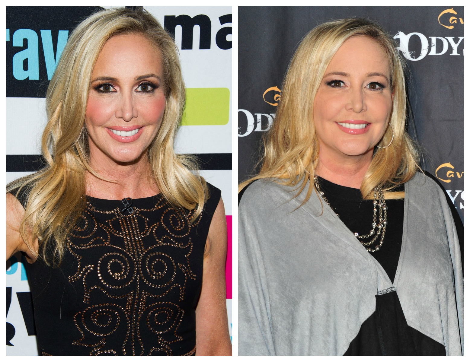Real Housewives Porn Stars - Real Housewives of Orange County' Star Shannon Beador Sparks Plastic  Surgery Rumors â€” See Her Transformation!