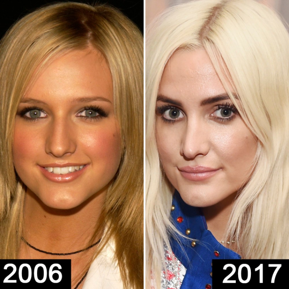 1000px x 1000px - Ashlee Simpson's Plastic Surgery: See Her Shocking Transformation