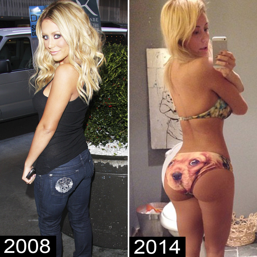 Before-and-After Pics of Celebrities With Rumored Butt Implants picture