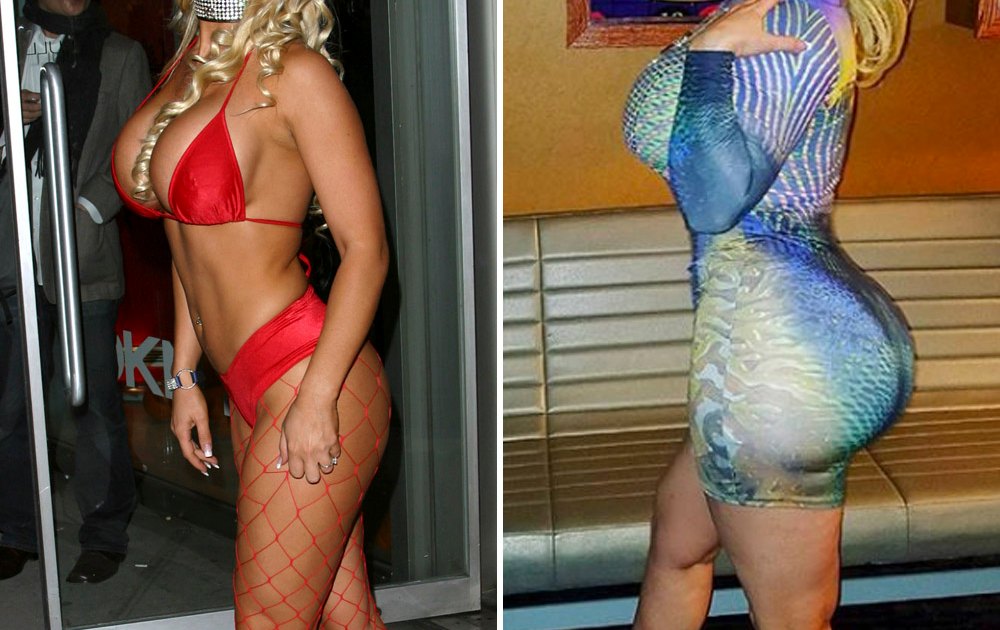 Huge Butt Implants Porn - Before-and-After Pics of Celebrities With Rumored Butt Implants