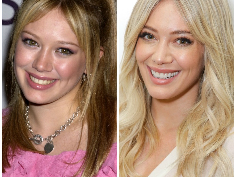 Plastic Surgery? Hilary Duff Reveals Secret to Age-Defying Glow!