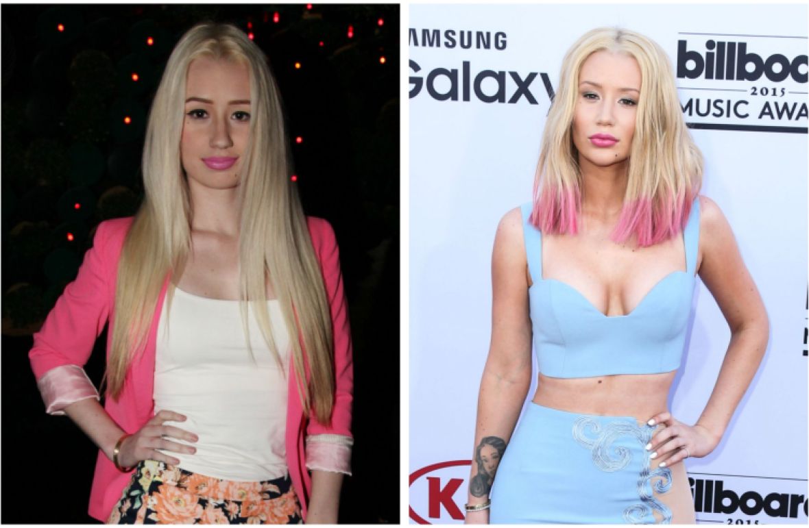 1180px x 771px - See What Iggy Azalea Looked Like Before All That Plastic Surgery!
