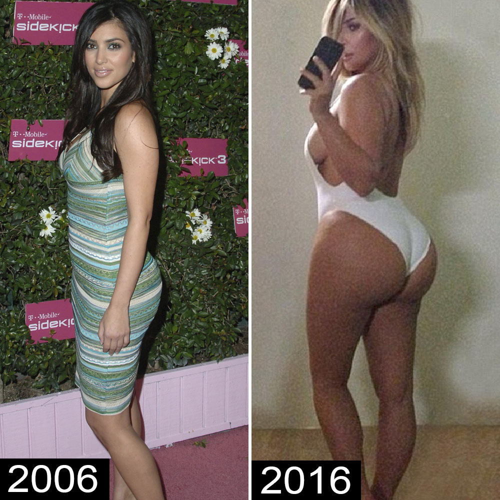 Who Says Butt Implants are a Bad Idea? - Poorly Dressed - fashion fail