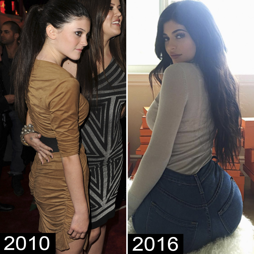 Before-and-After Pics of Celebrities With Rumored Butt Implants