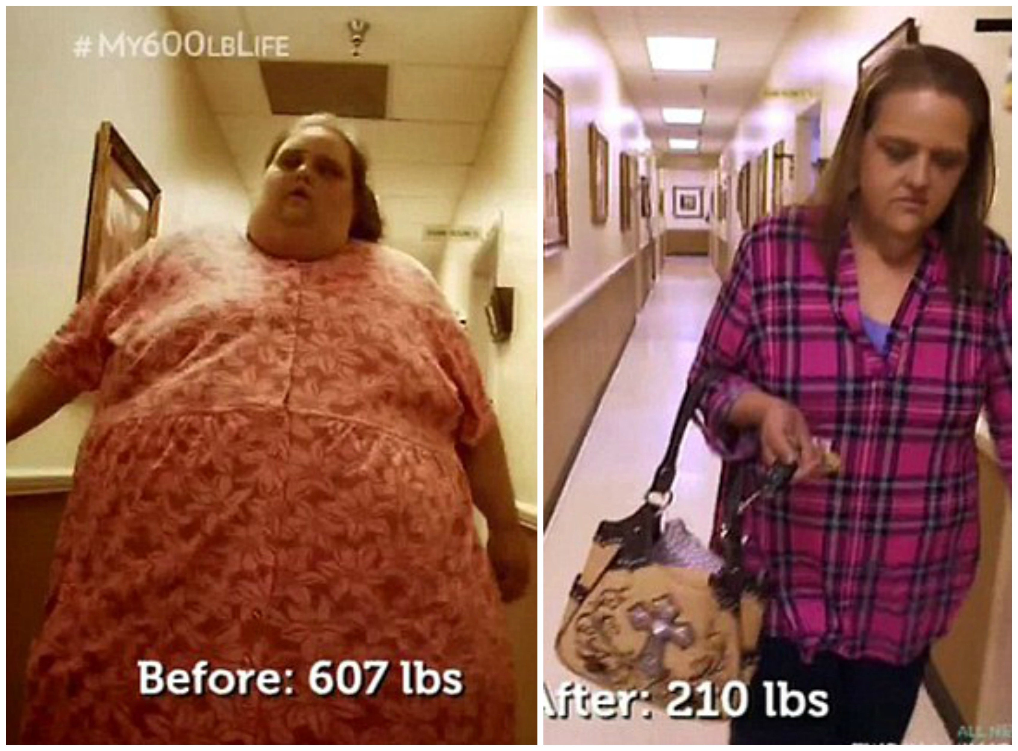 See What Susan From My 600 Lb Life Looks Like Now Life And Style 