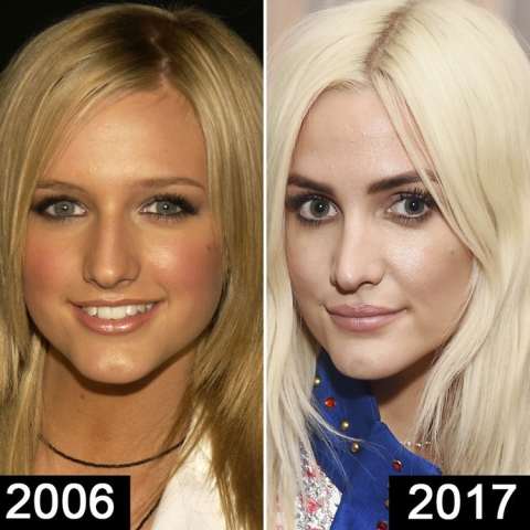  ashlee simpson chirurgie plastique