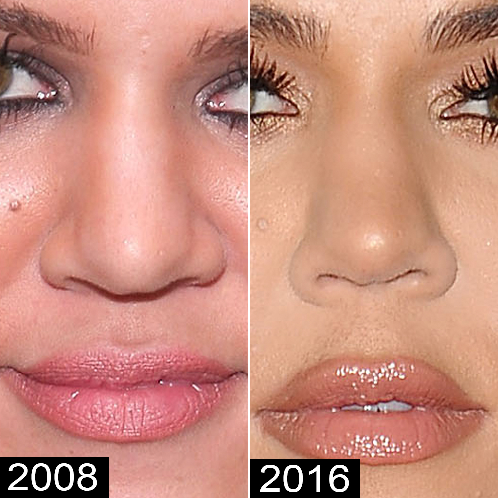 Khloe Kardashian looks unrecognizable with big lips & tiny nose in