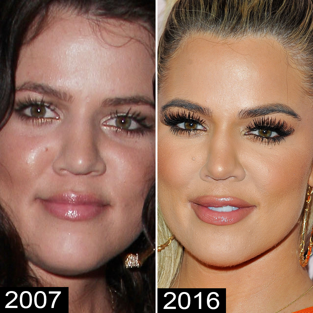 Khloé Kardashian Before And After See Her Complete Transformation