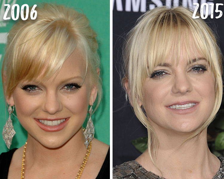 750px x 600px - Anna Faris Plastic Surgery: See How the Actress Has Transformed