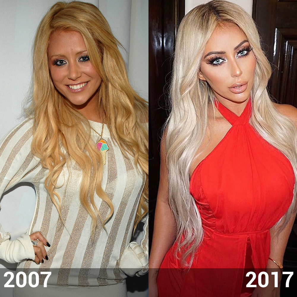 Plastic Surgery Watch Aubrey O Day S Body Transform Over Time