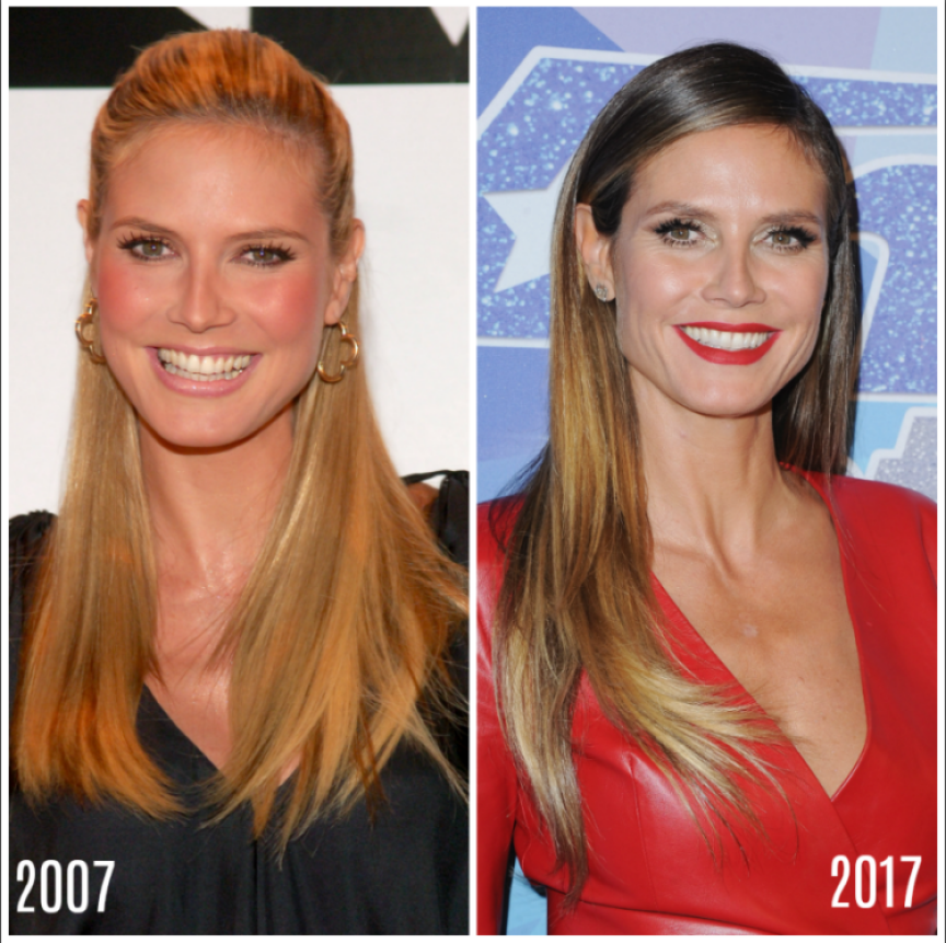 Heidi Klum Plastic Surgery Experts Weigh In On Her Ageless Beauty