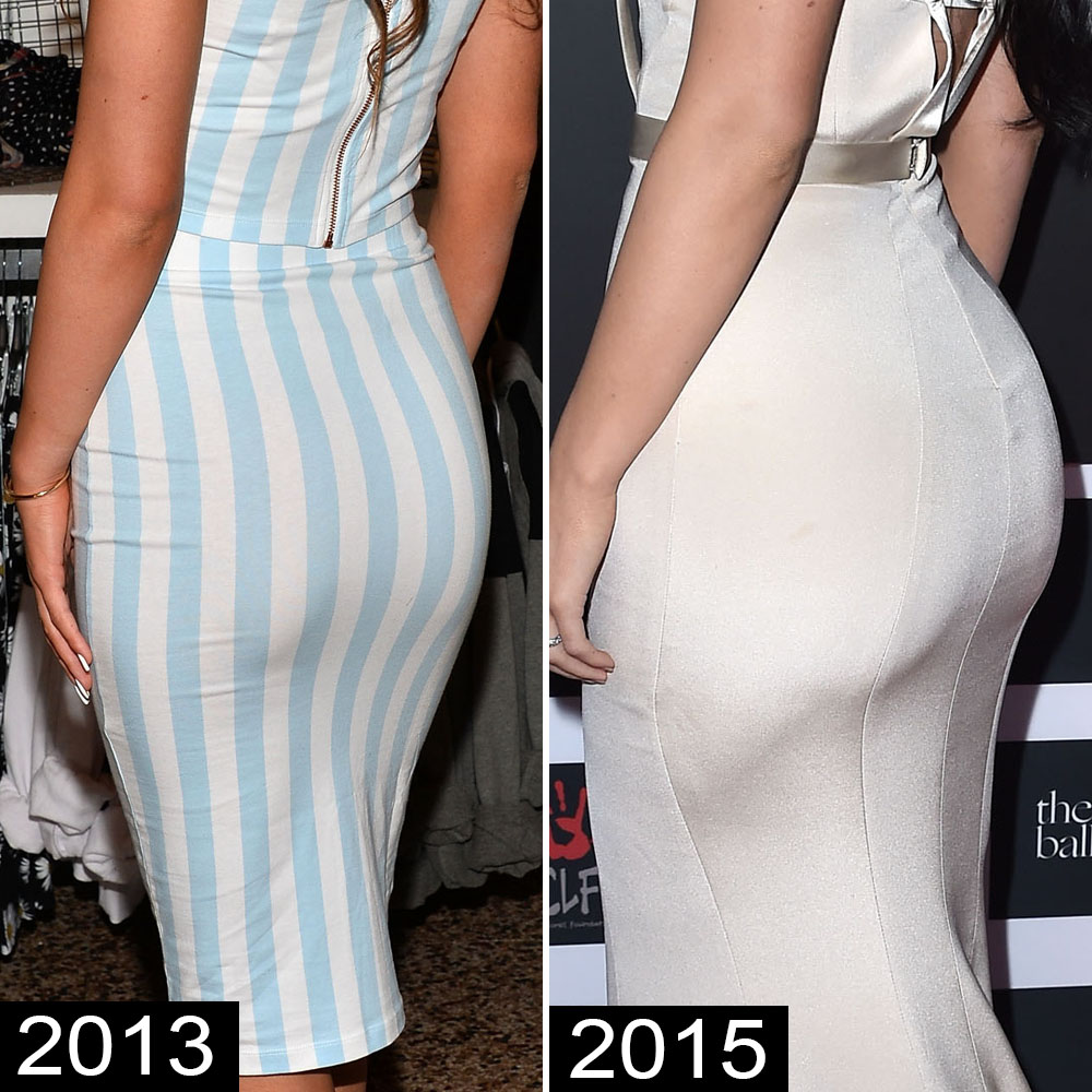 BUTT LIFTER Results- Secret to an Insta-Curvy Booty like Kylie