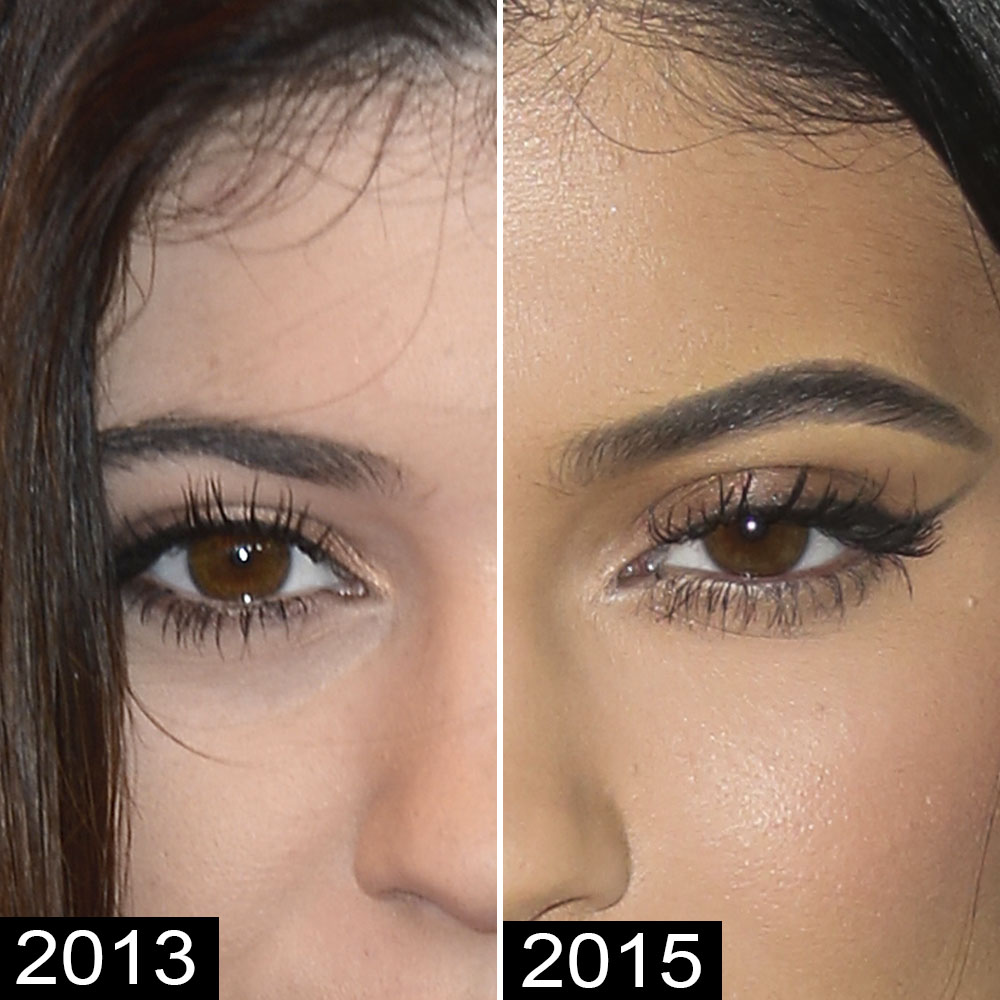 Kylie Jenner Has Seen Enough, According to the Tendril Blocking Her Eye —  See Photos
