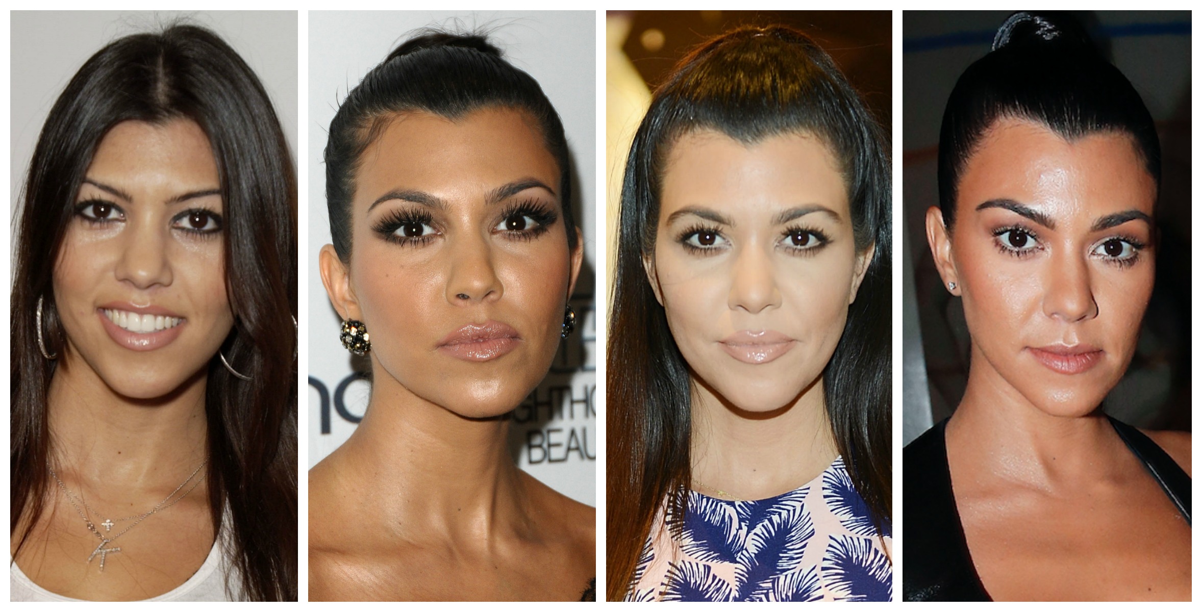 Plastic Surgery See The Kardashians Transformations Before Your Eyes