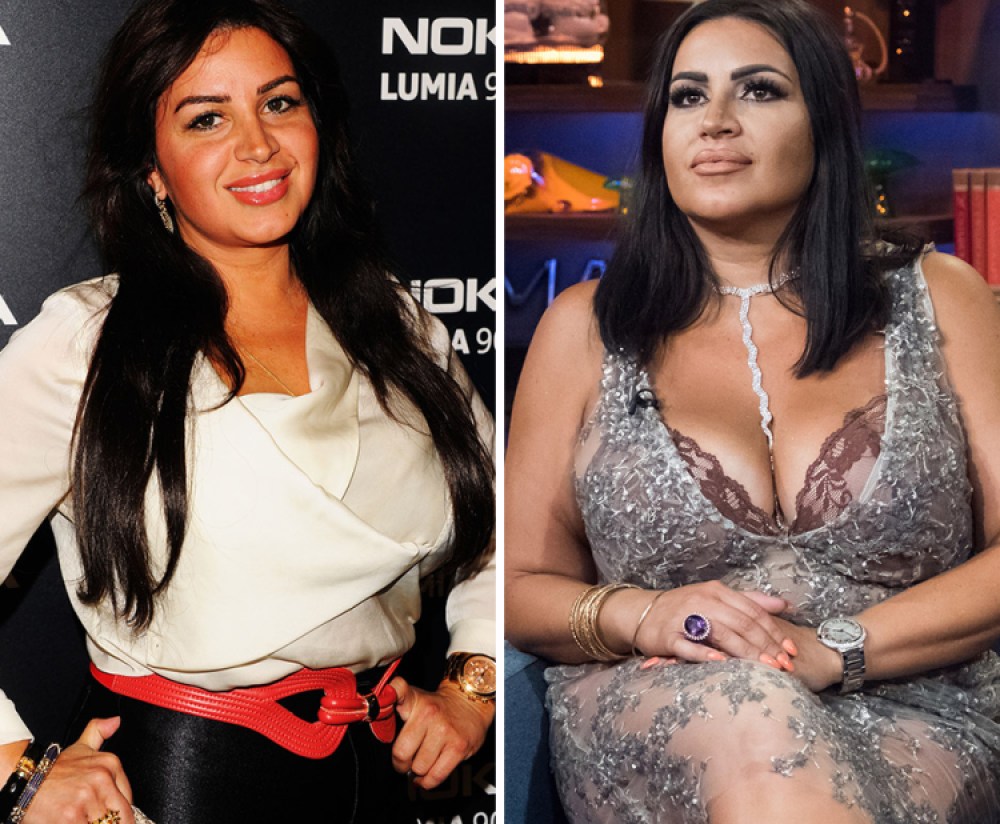 Shahs Of Sunset Star Mj Sparks Plastic Surgery Rumors After Premiere
