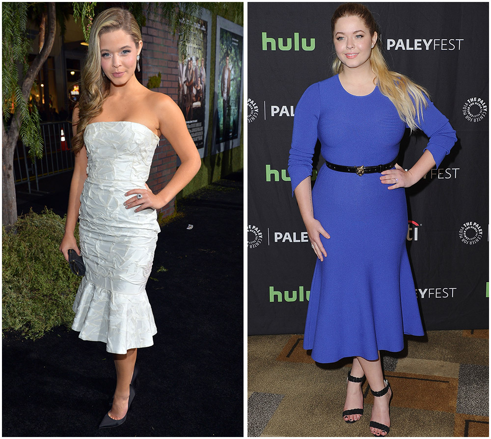 Sasha Pieterse Weight Gain: DWTS Fave Opens up About Hormone Imbalance