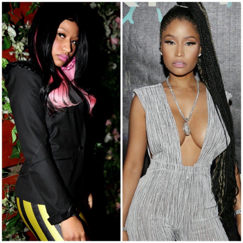 Celebrity Nicki Minaj Porn - See Nicki Minaj Before and After Butt Implants and Nose Job Rumors
