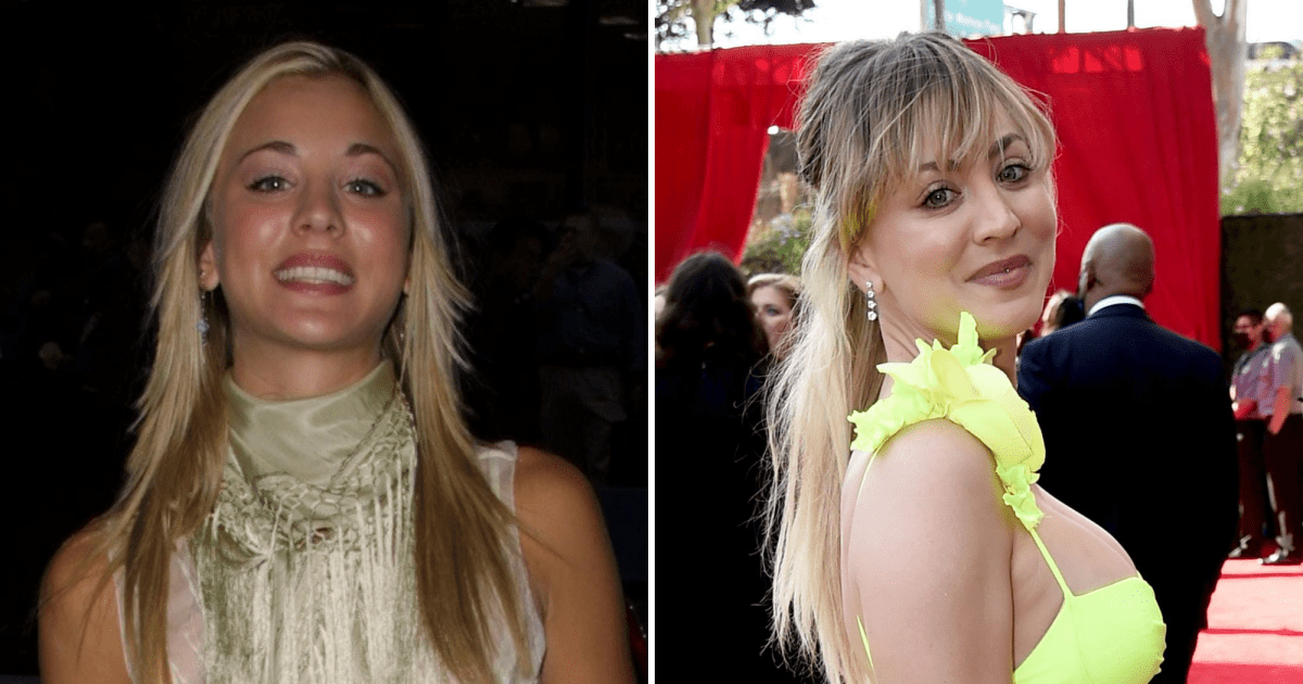 kaley cuoco before and after plastic surgery