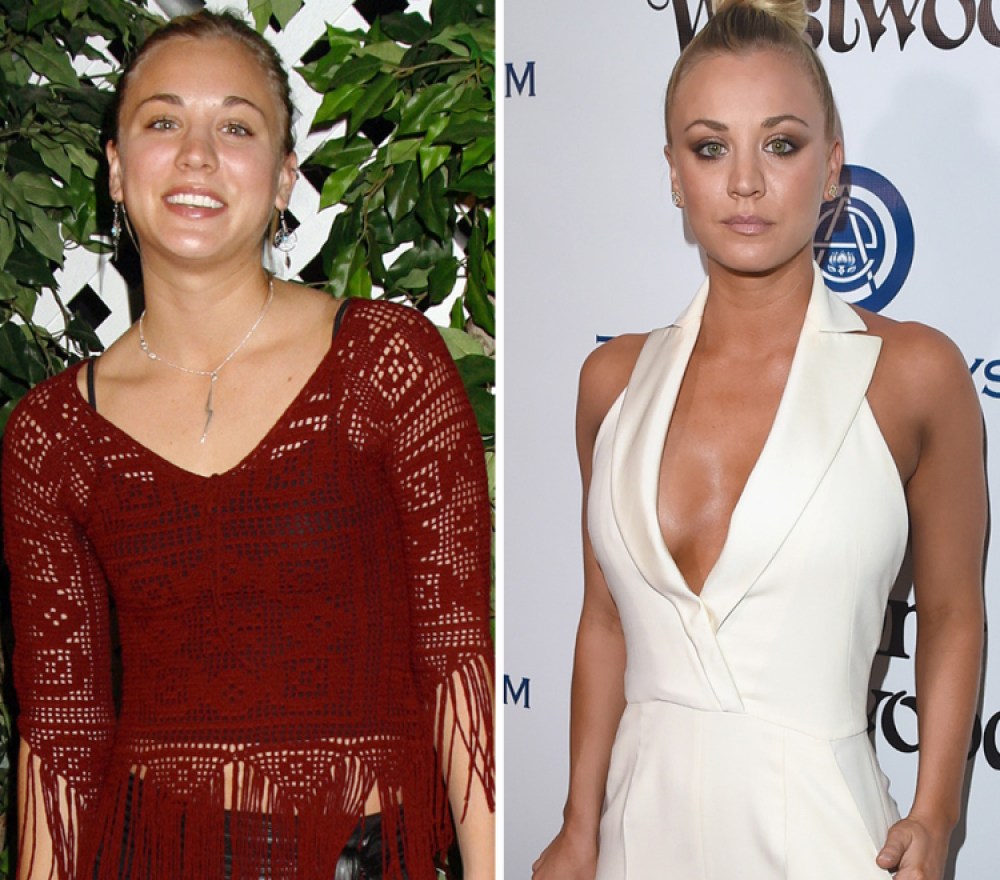 Kaley Cuoco Boobs Porn - Kaley Cuoco Breast Implants: See Her Plastic Surgery Transformation