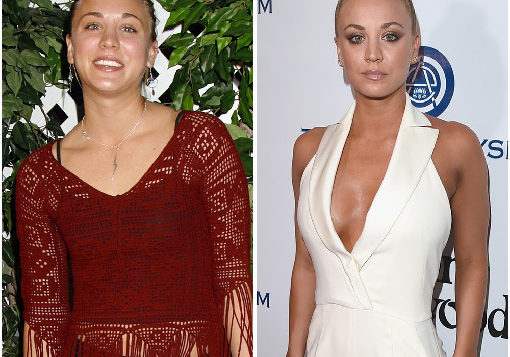 Kaley Cuoco Before And After Nose Job Job Retro