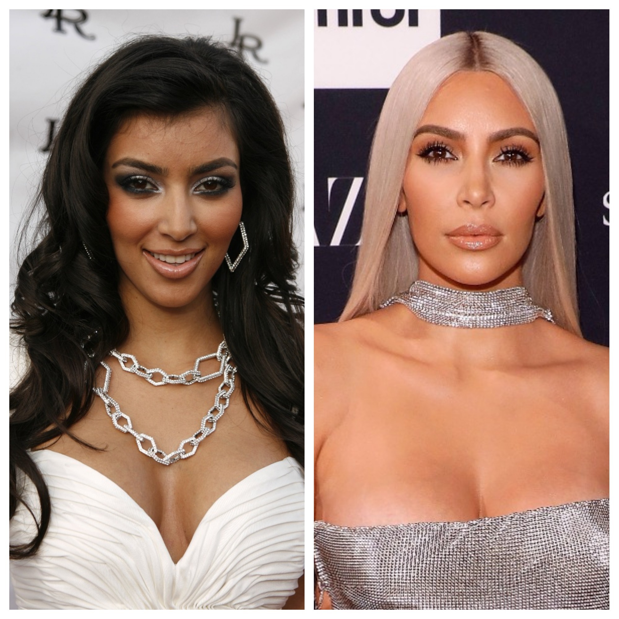 Kim Kardashian Before And After Plastic Surgery Timeline   Kim Kardashian Before After 