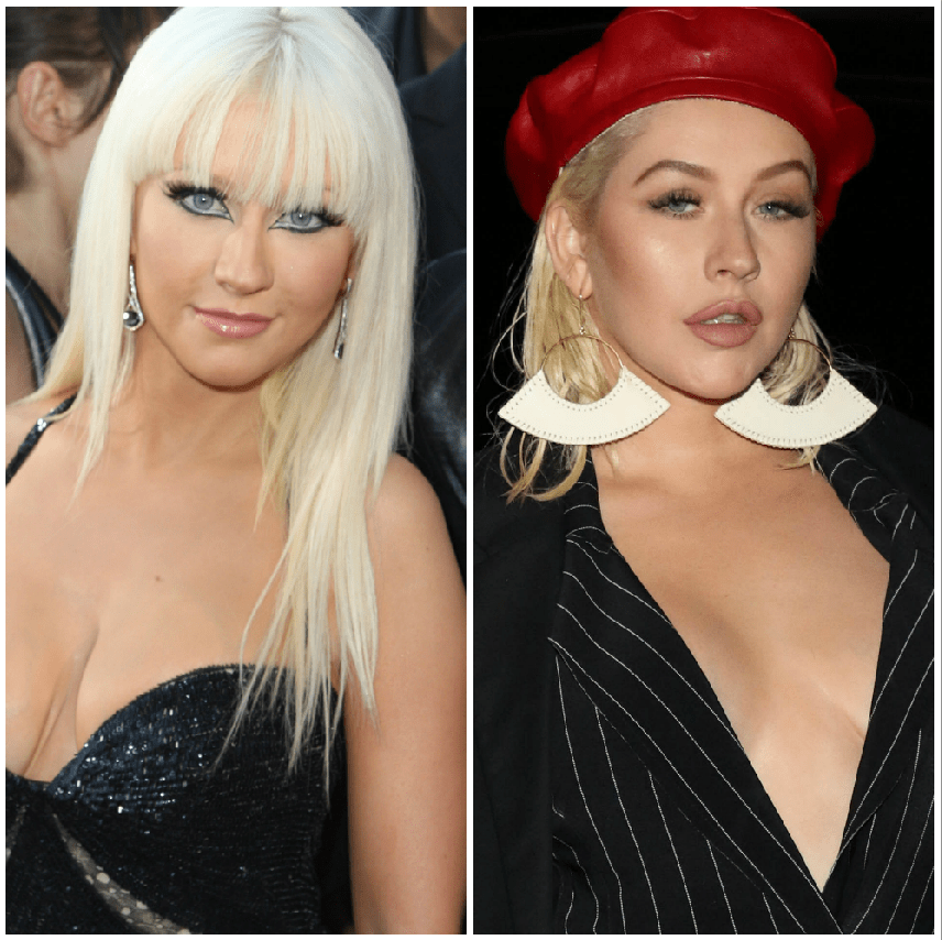 christina-aguilera-plastic-surgery-experts-weigh-in-on-transformation