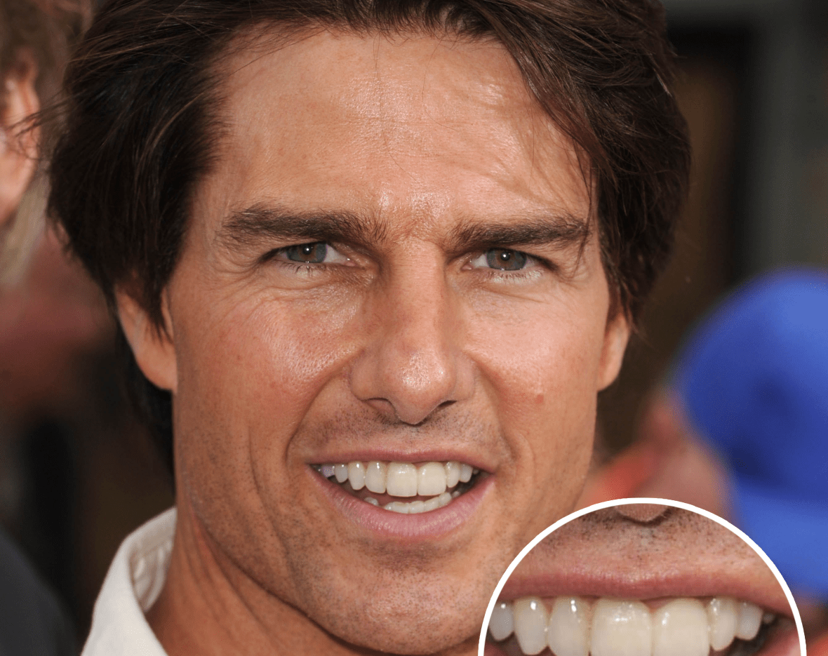 story behind tom cruise teeth