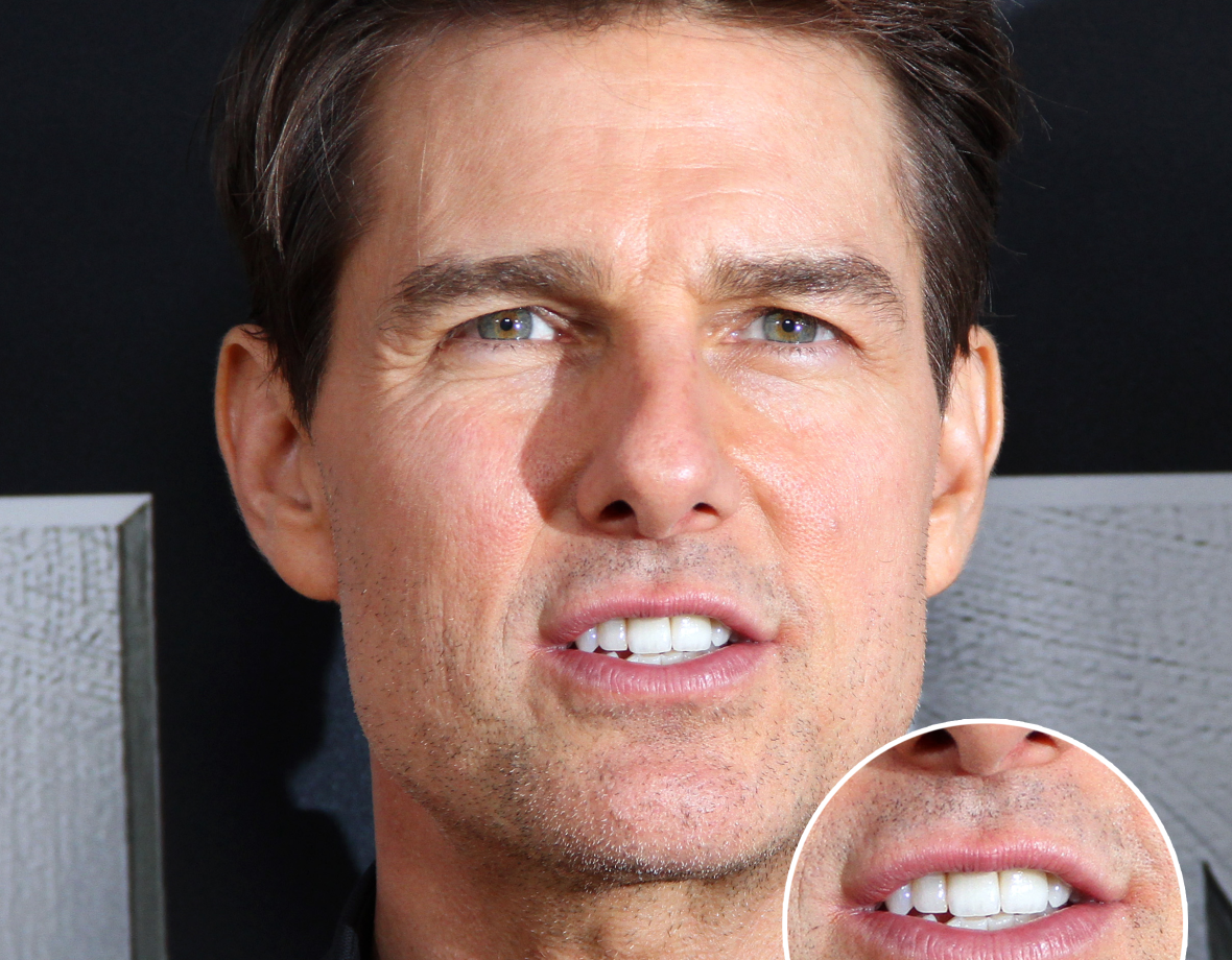 tom cruise front tooth in the middle of his face