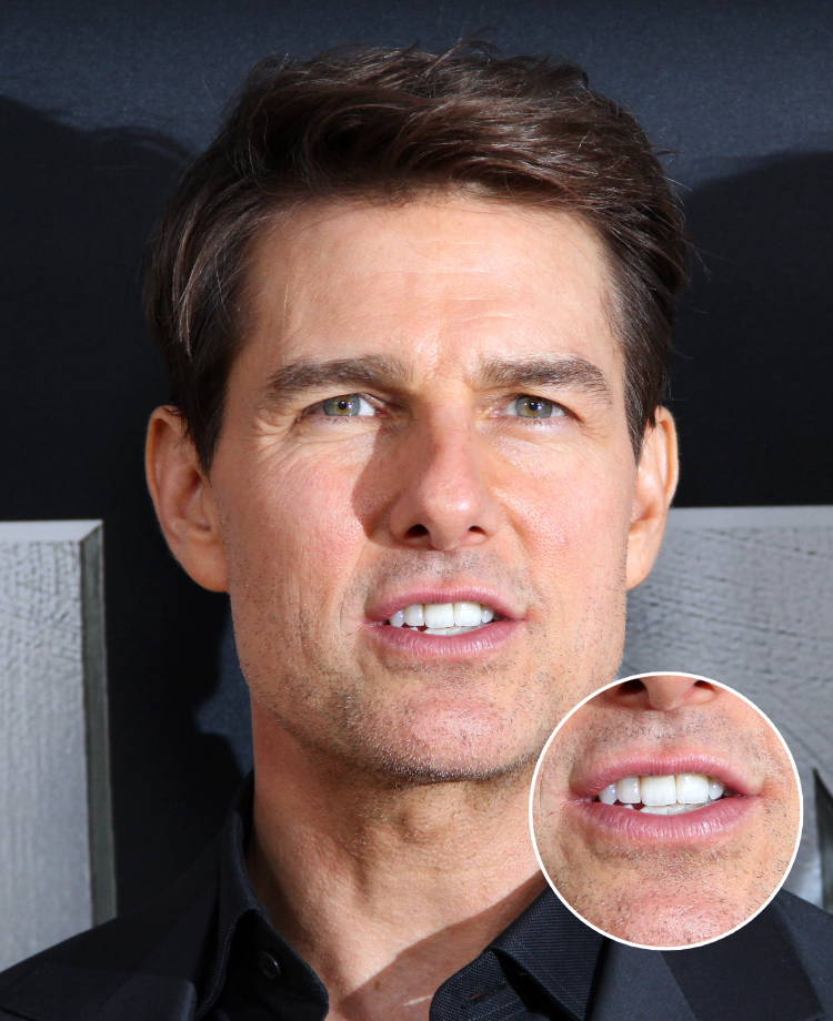 Tom Cruise S Middle Tooth The Story Behind His Smile