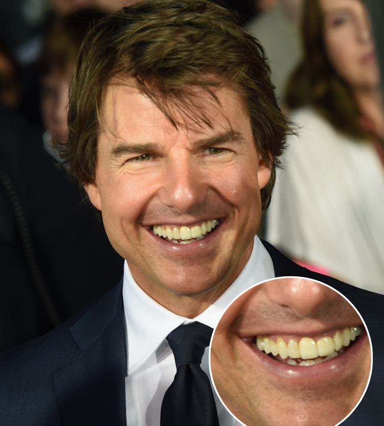 Tom Cruise S Middle Tooth The Story Behind His Smile