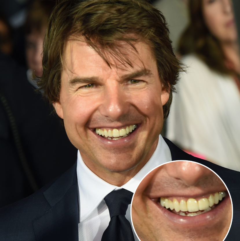 Tom Cruise's Middle Tooth — the Story Behind His Smile