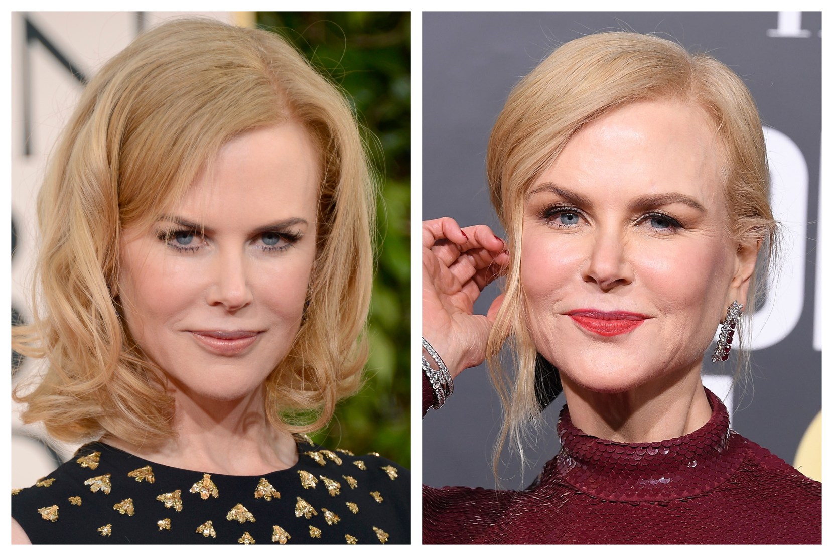 Nicole Kidman Displays 'TellTale' Signs of Plastic Surgery