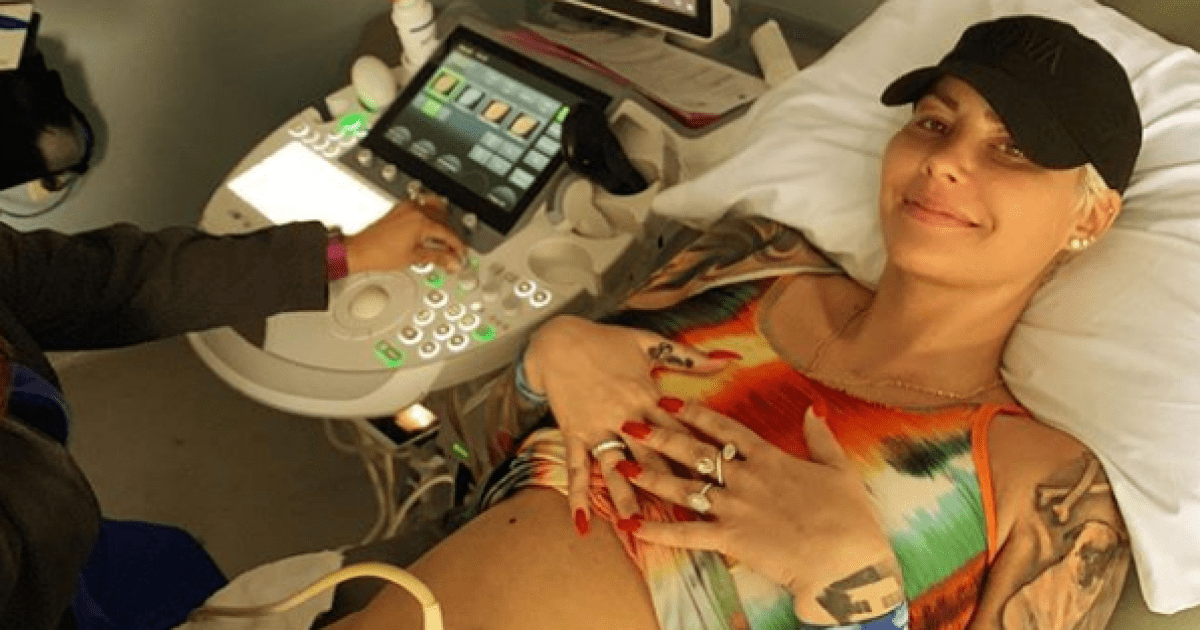 Amber Rose's Pregnancy Photos: See Her Journey With Baby No. 2