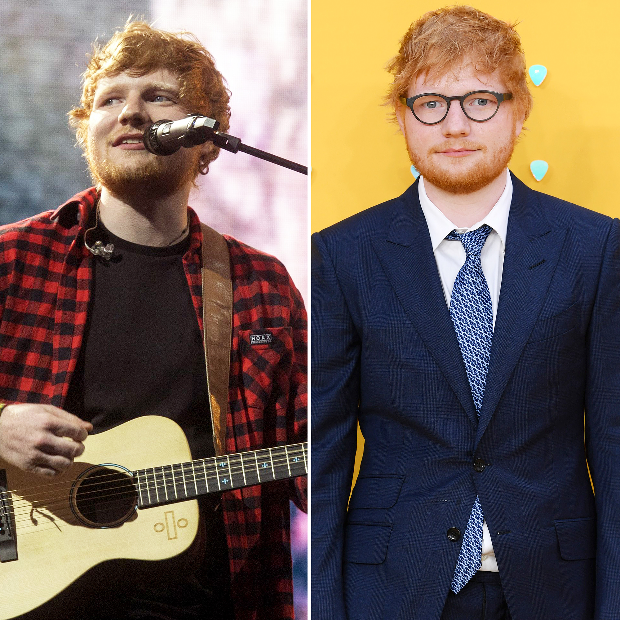 Ed Sheeran Weight Loss Transformations 2019