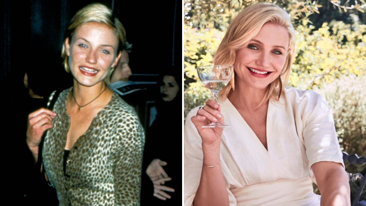 cameron diaz plastic surgery before and after